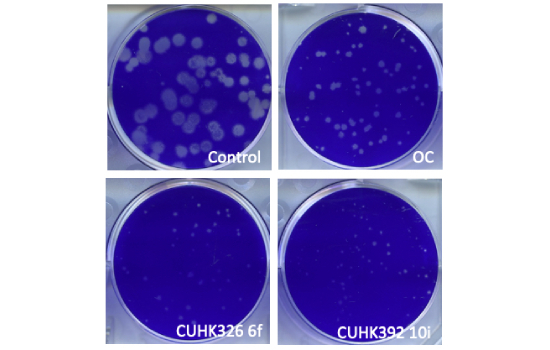 Read more about the article Inhibition of Influenza Virus Replication by Oseltamivir Derivatives